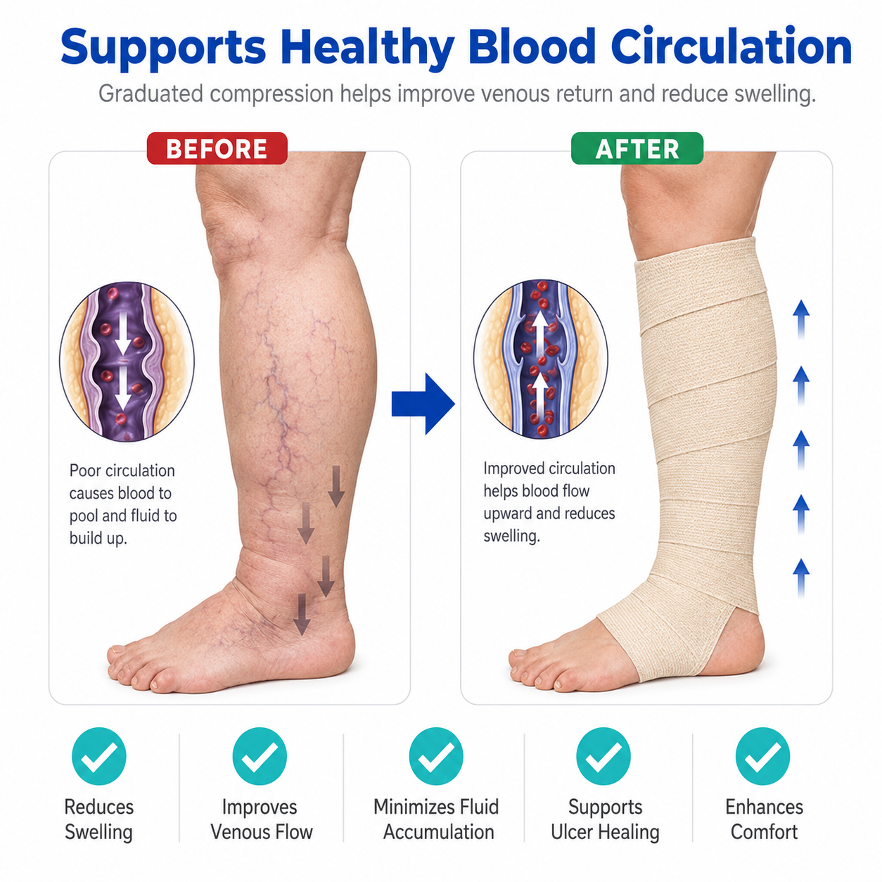 Vein CARE 4 Layer Compression Bandage for Venous Leg Ulcers
